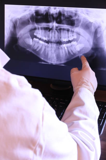 Best Emergency Dental Care for Sports Injuries in Lansdowne, VA